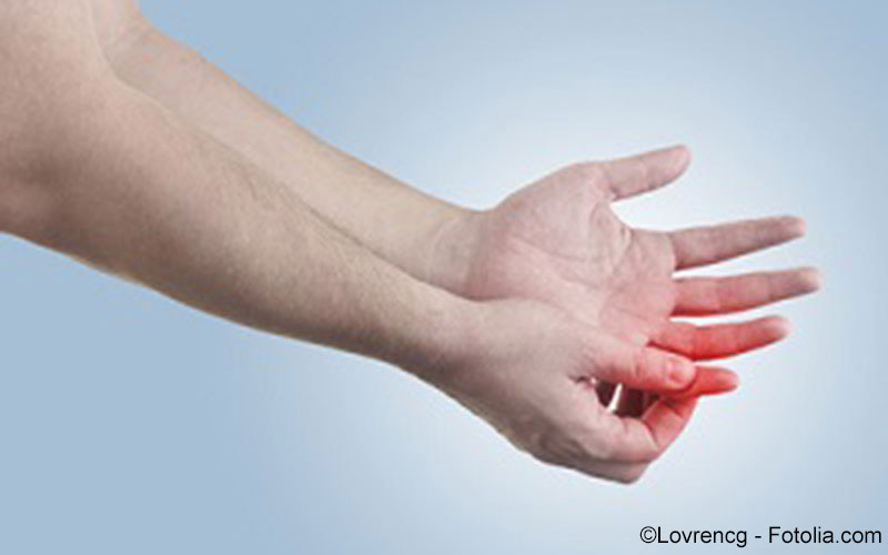 Arthritis, rheumatoide Arthritis, rheumatoide