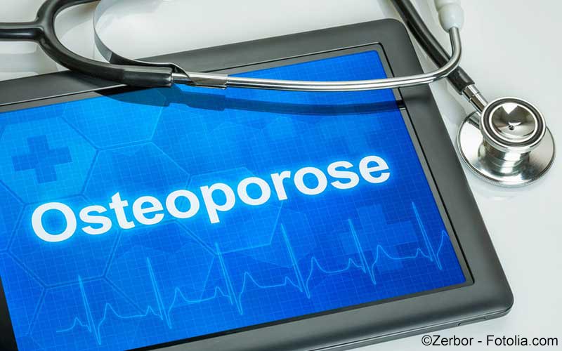 Osteoporose Osteoporose